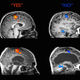 Image for article titled The neuroscience of comas, or what it means to be trapped inside your own mind